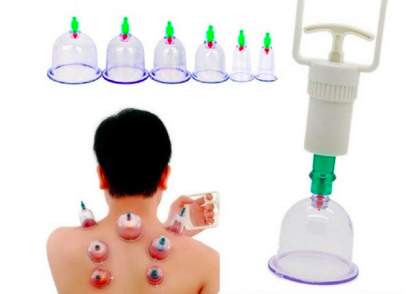 banke za vakuumsku terapiju